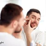 man touching his acne wondering does acne affect beard growth